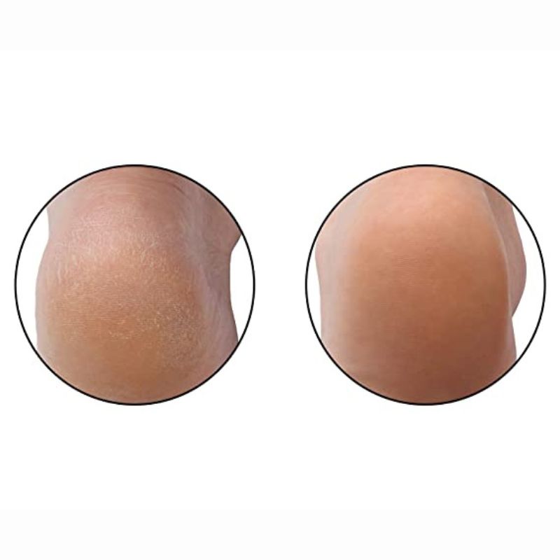 Microplane Personal Care - Transform your Soles Foot Filer